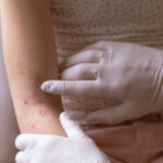 Dermatologist Abu Dhabi