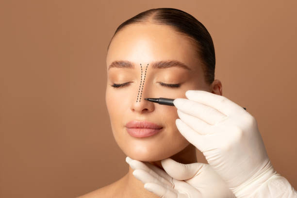 Rhinoplasty in Riyadh