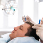 Hair transplant in Dubai