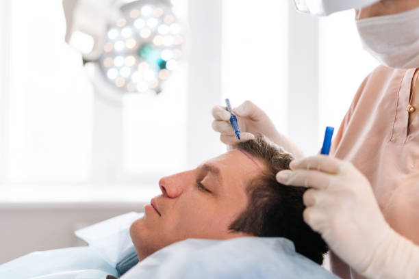 Hair transplant in Dubai
