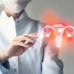 UTI Dyer and Bladder Epithelial Barrier Dysfunction in Chronic Cases