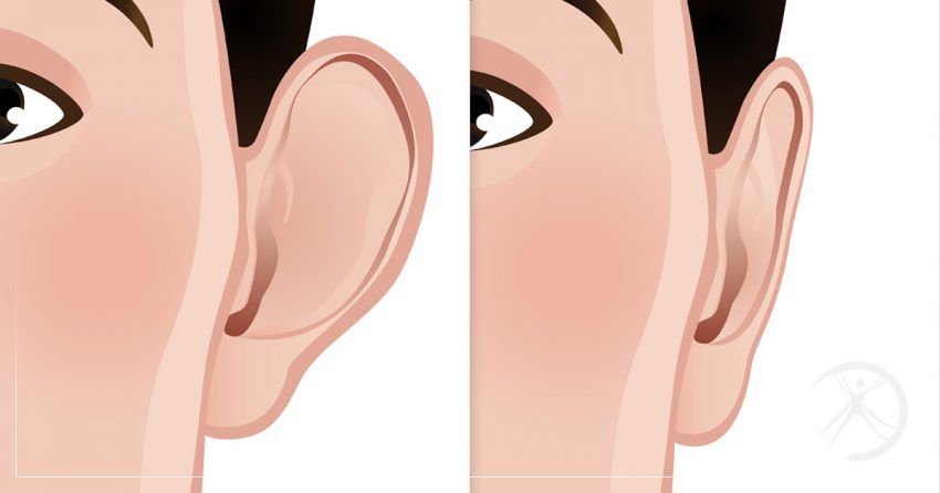 Ear Reshaping in Islamabad: Transform Your Look and Confidence