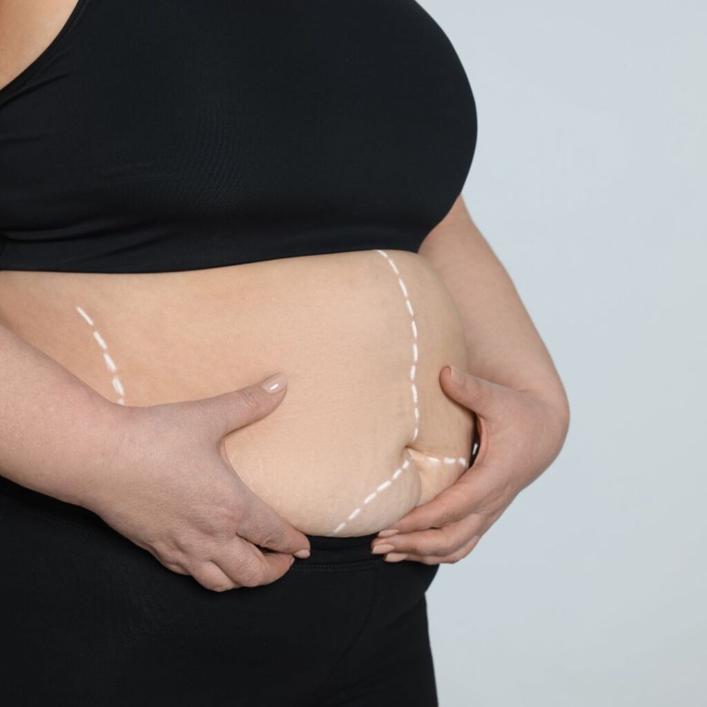 bariatric surgery in Islamabad