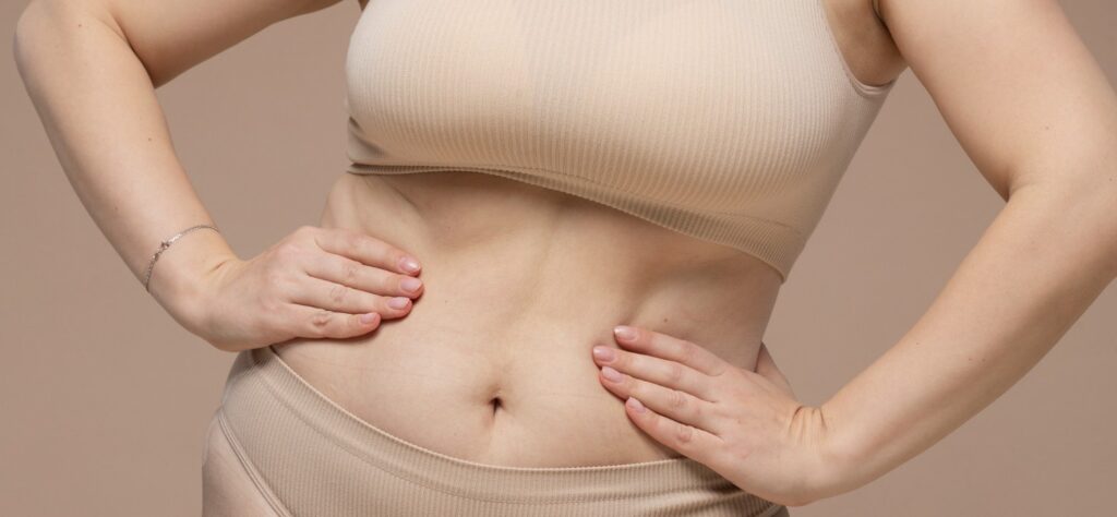 Liposuction in Dubai