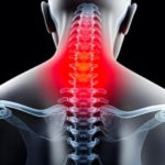 Navigating the World of Cervical Spine Surgeons in New Jersey