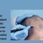 hair transplant clinic