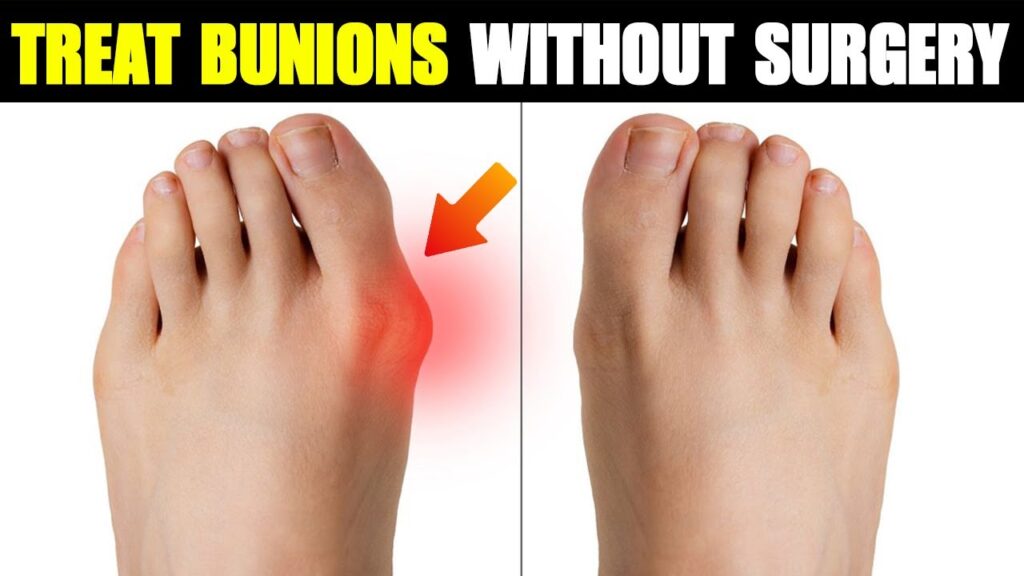 Bunion Treatment and Foot Pain Care in Edinburgh