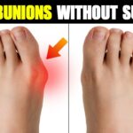 Bunion Treatment and Foot Pain Care in Edinburgh